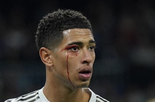 Real Madrid har problemer.